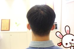 点击看大图 -大麦微针植发丨全国连锁