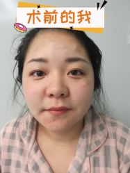 -素美医疗美容·西南眼鼻整形·修复基地