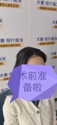 -大麦微针植发全国连锁