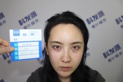 -大麦微针植发丨全国连锁