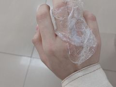 -杭州仁易堂中医康复医院疤痕修复