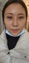 -西安壹加壹医疗美容·西北抗衰旗舰店