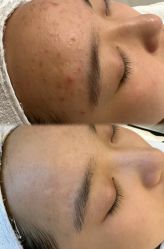 -美愈美肤MEIYU SKIN