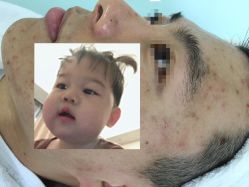 -痘博士北京·全国连锁祛痘机构