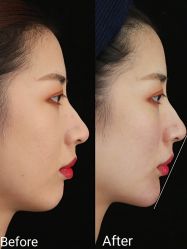 -上海伊莱美医疗美容医院