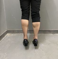 体验前-重庆军美医疗美容医院