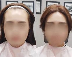 -发饰美男士增发补发假发定制店