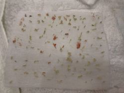 -痘庄科学祛痘国际连锁