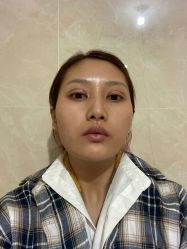-深圳阳光医疗美容医院·旗舰店
