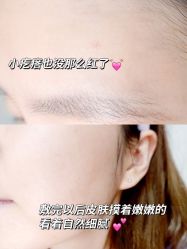 -皇族养心堂·净痘·修敏·御颜