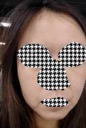 体验前-厦门美莱整形美容医院