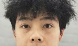 -天津健丽·去眼袋医疗美容机构