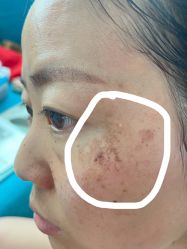 点击看大图 体验后-广东韩妃整形外科医院