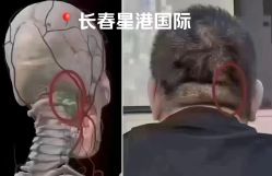 -星港国际·Skin皮肤专研·皮肤管理
