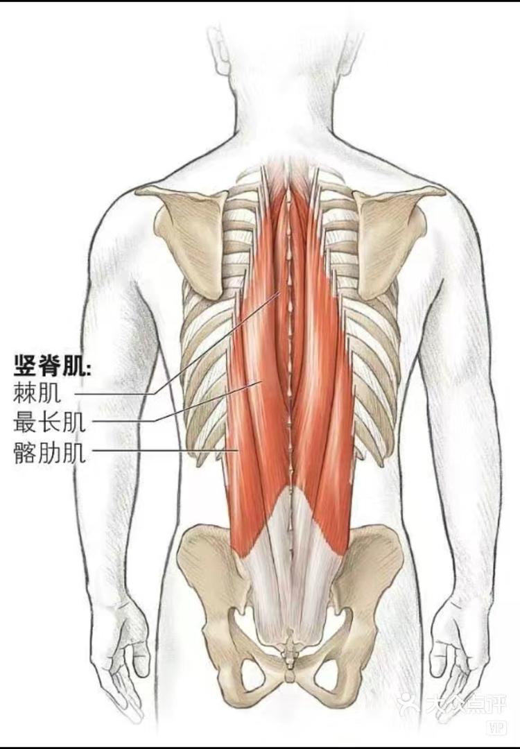 竖脊肌位置图片图片