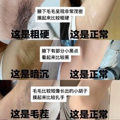 -薇兰专业脱毛连锁机构