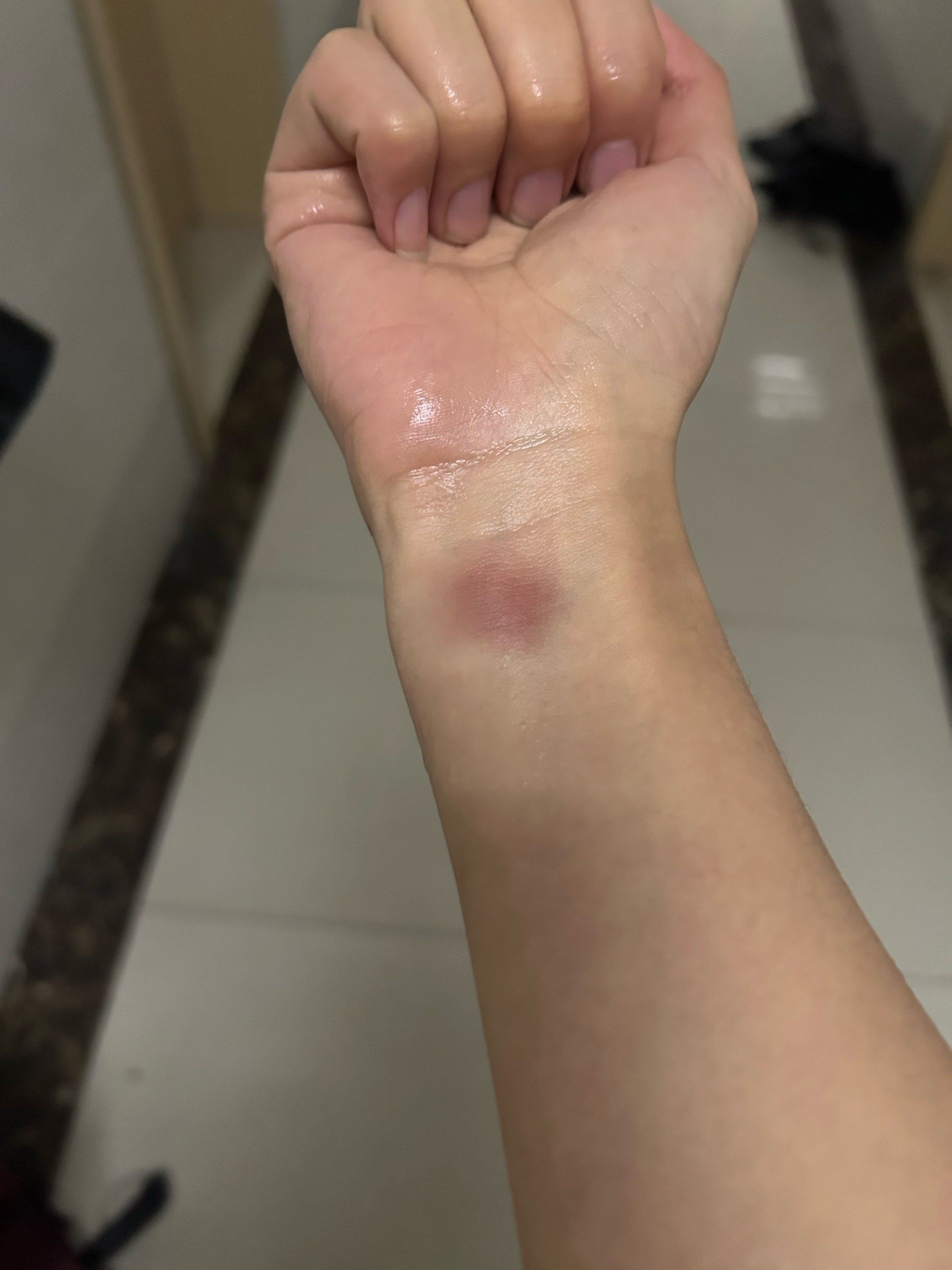 0元玩转这座城为什么我打羽毛球会变成这样啊
直接把手腕给打的淤青