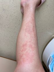 -广州安和泰医学月子会所