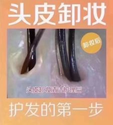 -希梵尔头皮抗衰·科技养发