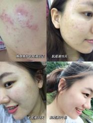 -凡碧诗毛孔收细