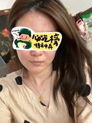 -珍贞佰俪·针清祛痘印敏感管理