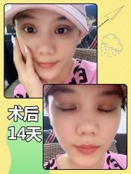 -广东韩妃整形外科医院