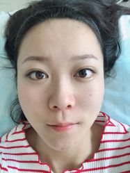 -宜肤清颜专业祛痘问题肌修护