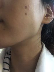 -空军总医院激光整形美容中心