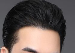 -大麦微针植发丨全国连锁