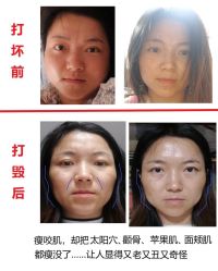 -上海玫瑰医疗美容医院