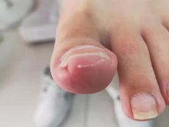 -新甲连锁灰指甲·甲沟炎·鸡眼(黑龙江路店)