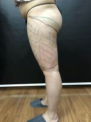 -洁铭新加坡医美