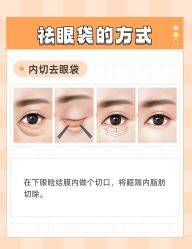 -广州健丽·去眼袋医疗美容机构