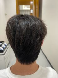 -大麦微针植发全国连锁