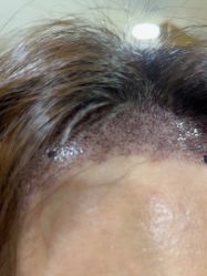 -熙朵美学植发·连锁品牌