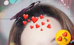 -大麦微针植发全国连锁