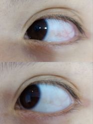 -晶奕空间专业脱毛连锁机构