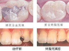 -团圆口腔·种植中心(锦江院区)