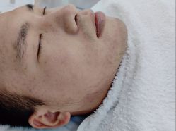 点击看大图 -友仟痘医生科学祛痘连锁