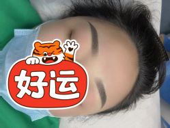 -郡艺医疗美容·微整·眼鼻吸脂