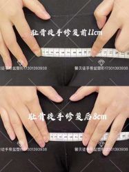 -梦斯绮私密催乳修复中心