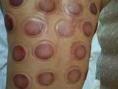 -益友堂盲人推拿正骨穴位按摩工作室