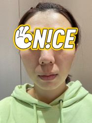 体验后-杭州米兰柏羽医疗美容医院