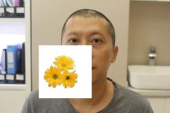 -大麦微针植发丨全国连锁