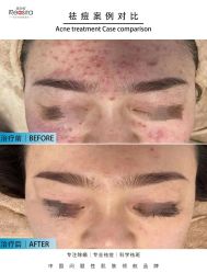 -黎蓓露·徒手骨雕蛋白抗衰·调肤管理