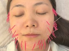 -承启堂中医馆·推拿·针灸·把脉(青羊馆)