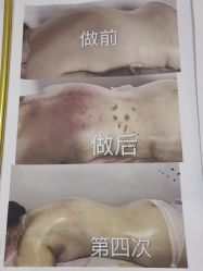 -瘦立方身材管理中心