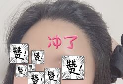 -大麦微针植发全国连锁