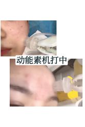 -八大处整形