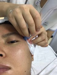 -痘博士北京·全国连锁祛痘机构